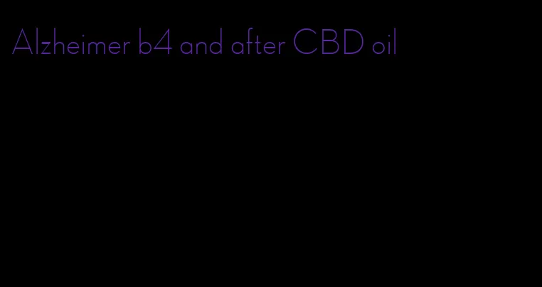 Alzheimer b4 and after CBD oil