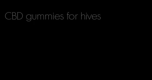 CBD gummies for hives