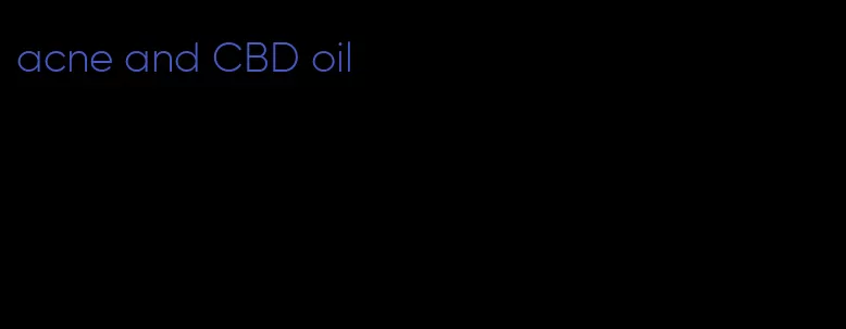 acne and CBD oil