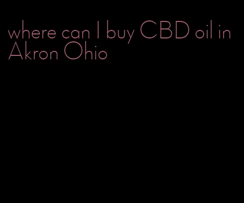 where can I buy CBD oil in Akron Ohio