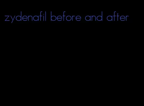 zydenafil before and after